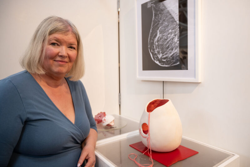 Women stands in front of an art display during an exhibition. There is a picture of mammogram.