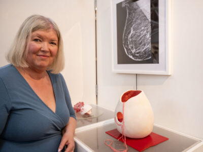 NWRC Student Transforms Cancer Journey into expressive art collection
